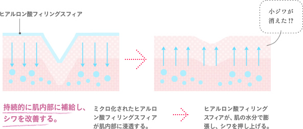 ヒアルロン酸フィリングスフィア 小ジワが消えた!?